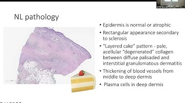 "Necrobiosis- Pathophysiology and Management," Emanual Maverakis, MD, Professor of Dermatology