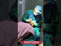 HAIR TRANSPLANT FULL PROCESS 💯 #shortfeed #shortvideo #hairtransplant #patna