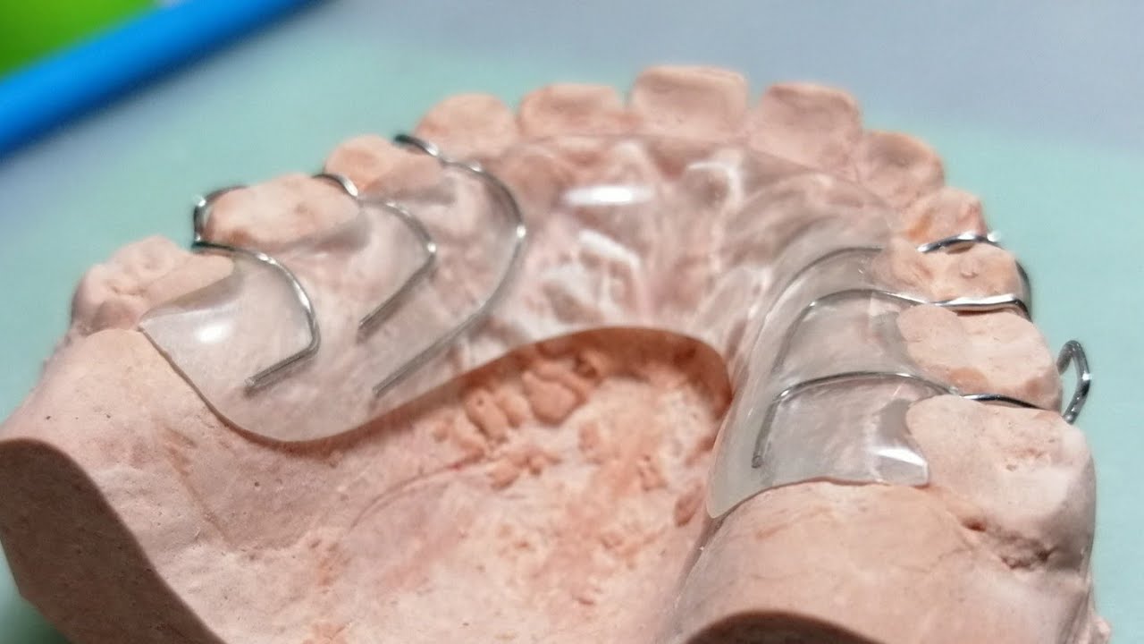 El Hawley no se olvida [CDP #3]