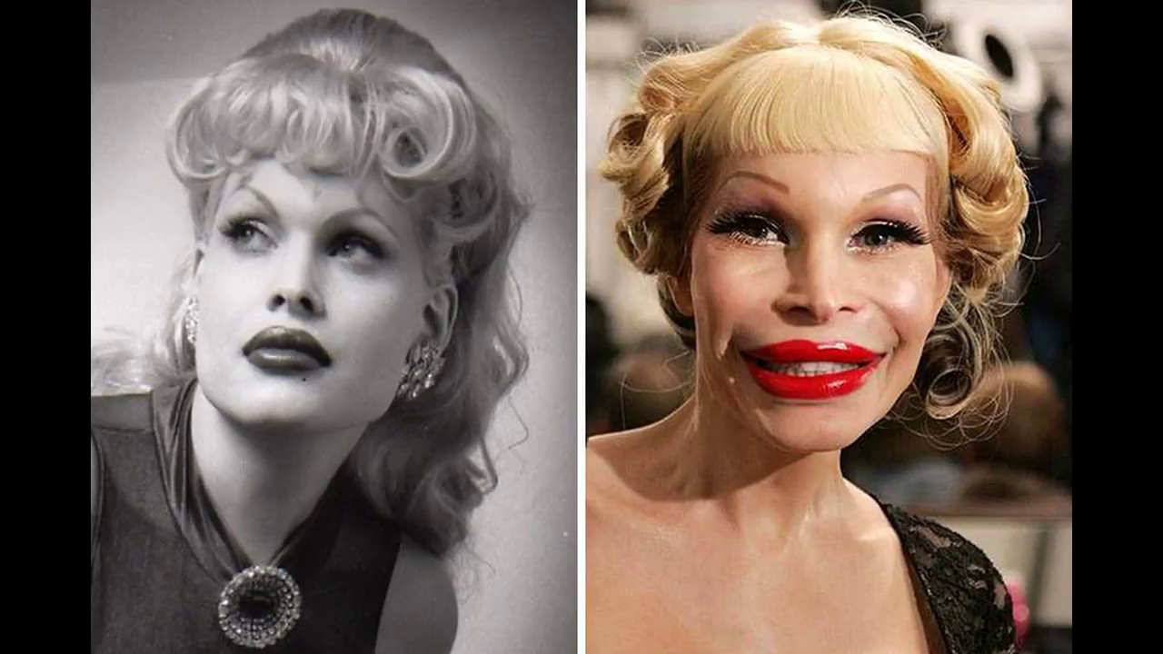 10 ШОКИРУЮЩИХ ПЛАСТИЧЕСКИХ ОПЕРАЦИЙ