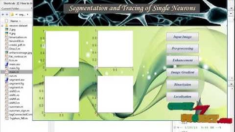Final Year Projects | Segmentation and Tracing of Single Neurons from 3D Confocal Microscope Images