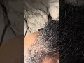 Quick Dandruff Beard Scratch