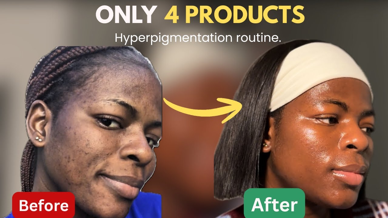 I Cleared My Hyperpigmentation Using ONLY 4 Products (Morning Routine).