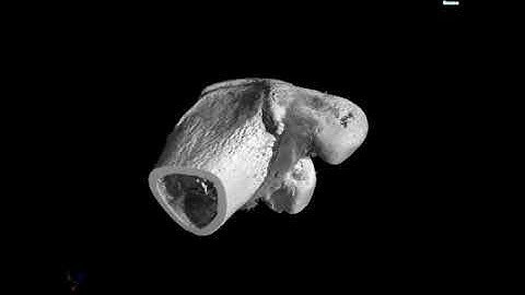 Observation of a Mouse Femur with X-Ray CT