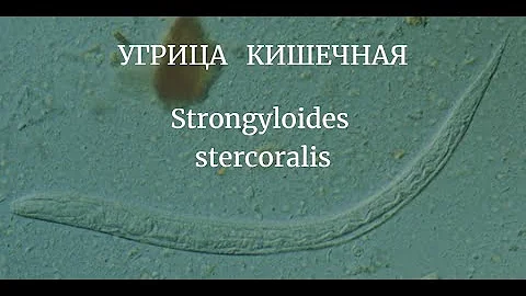 Угрица Кишечная Stongyloides stercoralis/ Морфология Размеры Жизненный Цикл Диагностика Профилактика