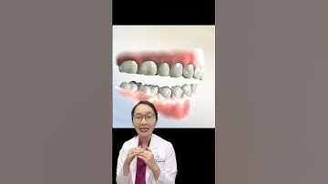 Giải thích video về kỹ thuật cơ học răng miệng #shorts