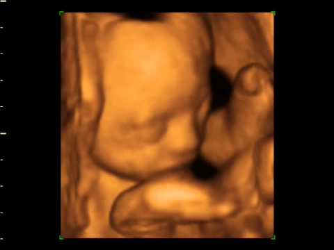 window to the womb bexleyheath 25wks 4D Ultrasound baby scan. Window to the Womb Ltd