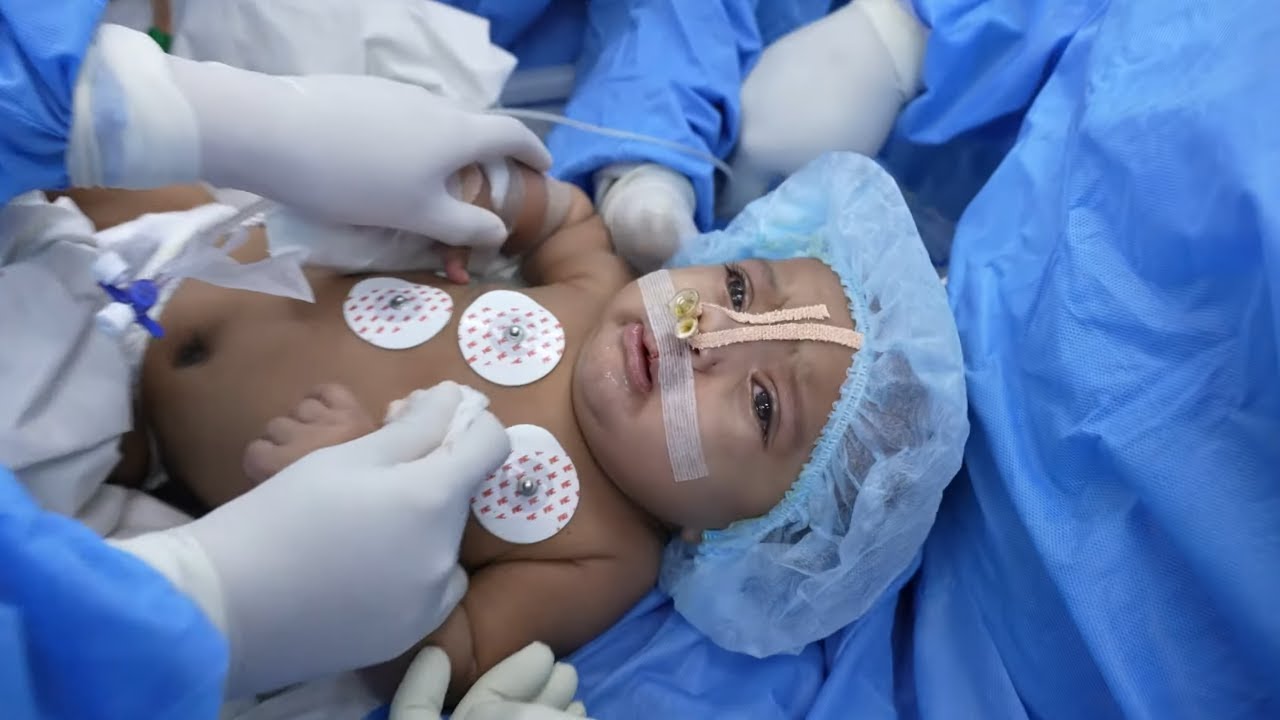 Baby child waking up after Surgery YouTube