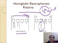 HPLC interpretation part 1