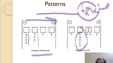 HPLC interpretation part 1