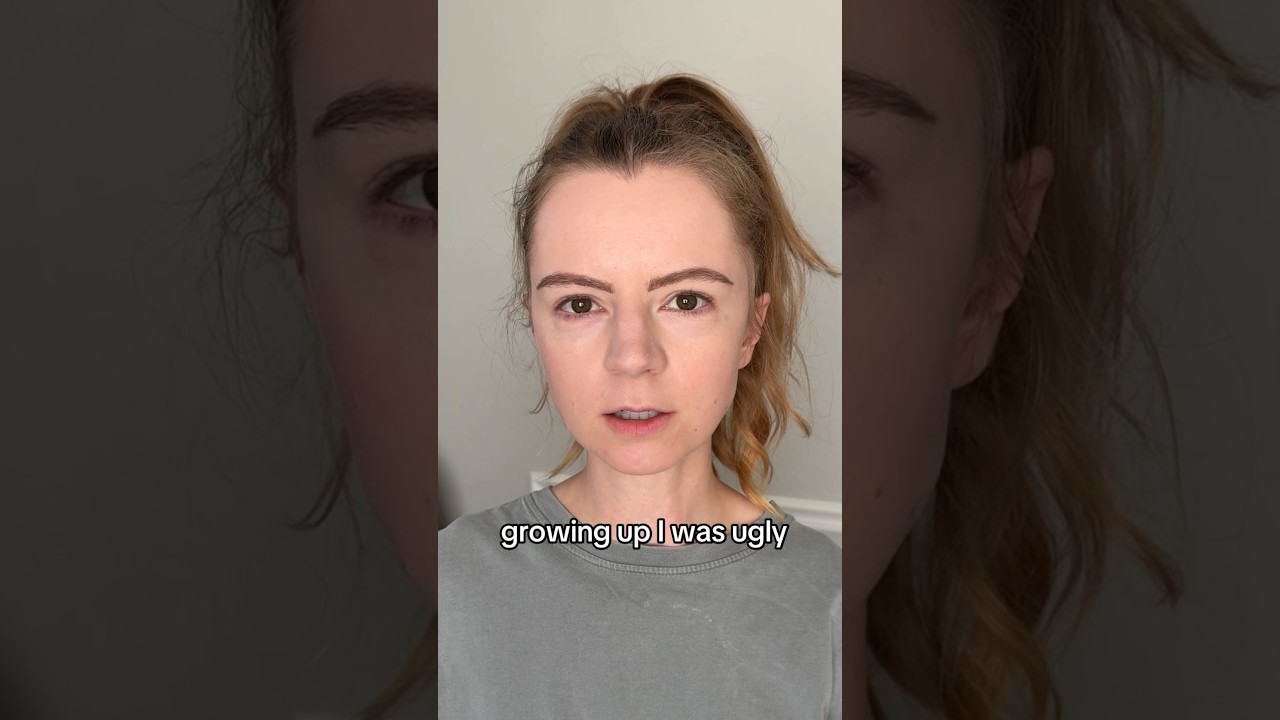 Growing Up Ugly
