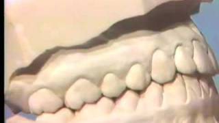 Occlusal Examination of Correctly Articulated Casts