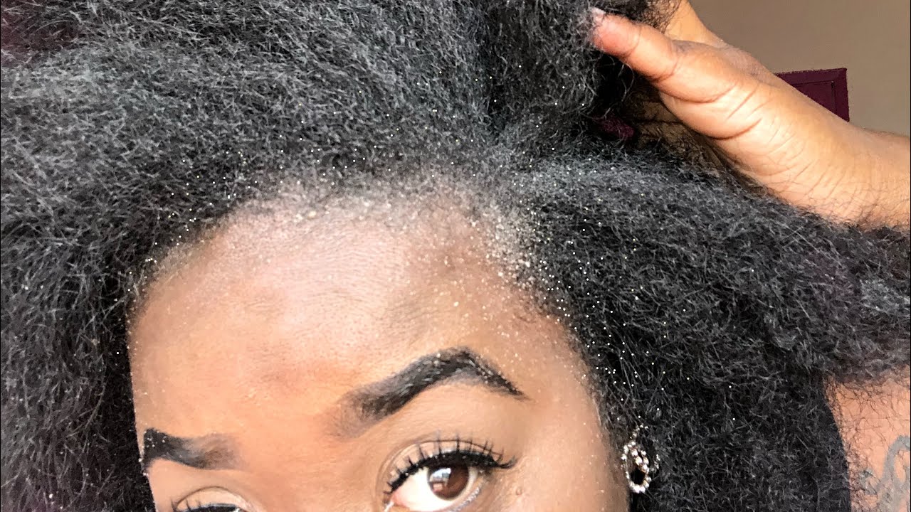 Extreme Dandruff Flakes 🎃 |ASMR scratching Sounds | Comb Flakes Removal | Vlogtober