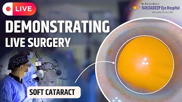 Intumescent cataract Dr Sourabh D Patwardhan 3D live Phaco surgery.