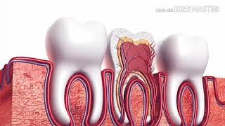 #dthealthtips#root#canal Whta is root canal treatment  100% in bangladesh( রুট ক্যানেল কি) screenshot 4