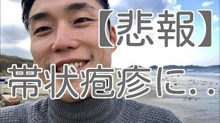 【悲報】帯状疱疹になりました。。