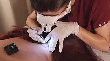 ASMR Longest Full SCALP Exam : Sensory Tests, Lice Removal, Skin Check & Hair Parting