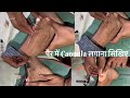 पैर में Cannula कैसे लगाए आइए देखिए/Cannula insertion#nurses #cannulainsertion #ytshortsvideo #neet