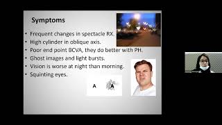 RGP Lenses for Irregular Cornea
