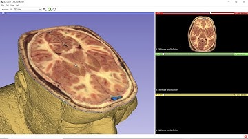 Demonstration of the major motor structures using data from the visible human project