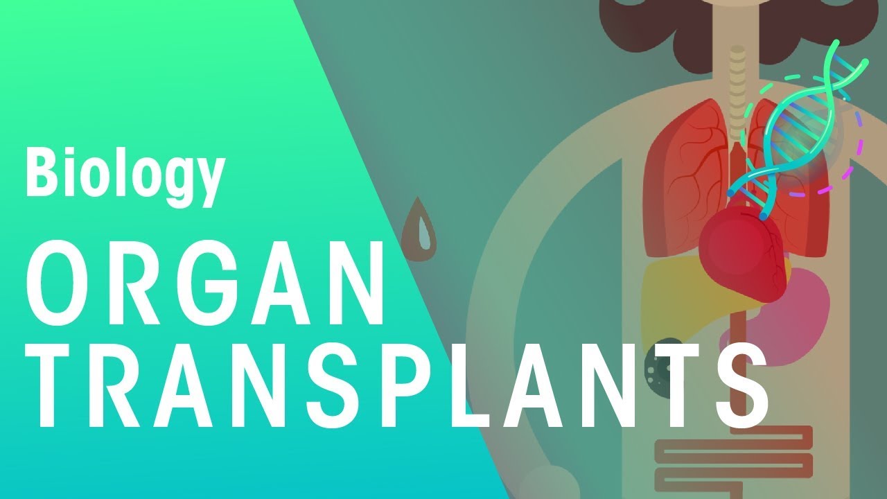 Organ Transplants and Ethics