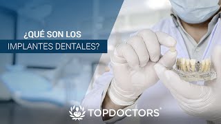 ¿Qué son los implantes dentales?