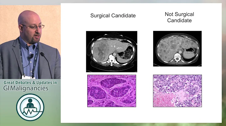 Debate: Is there a role for surgical management of metastatic neuroendocrine cancer? - No