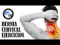 Hernia discal cervical o hernia de disco cervical tratamiento y ejercicios para aliviar el dolor