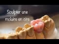 Sculpture molaire en cire  prothse dentaire