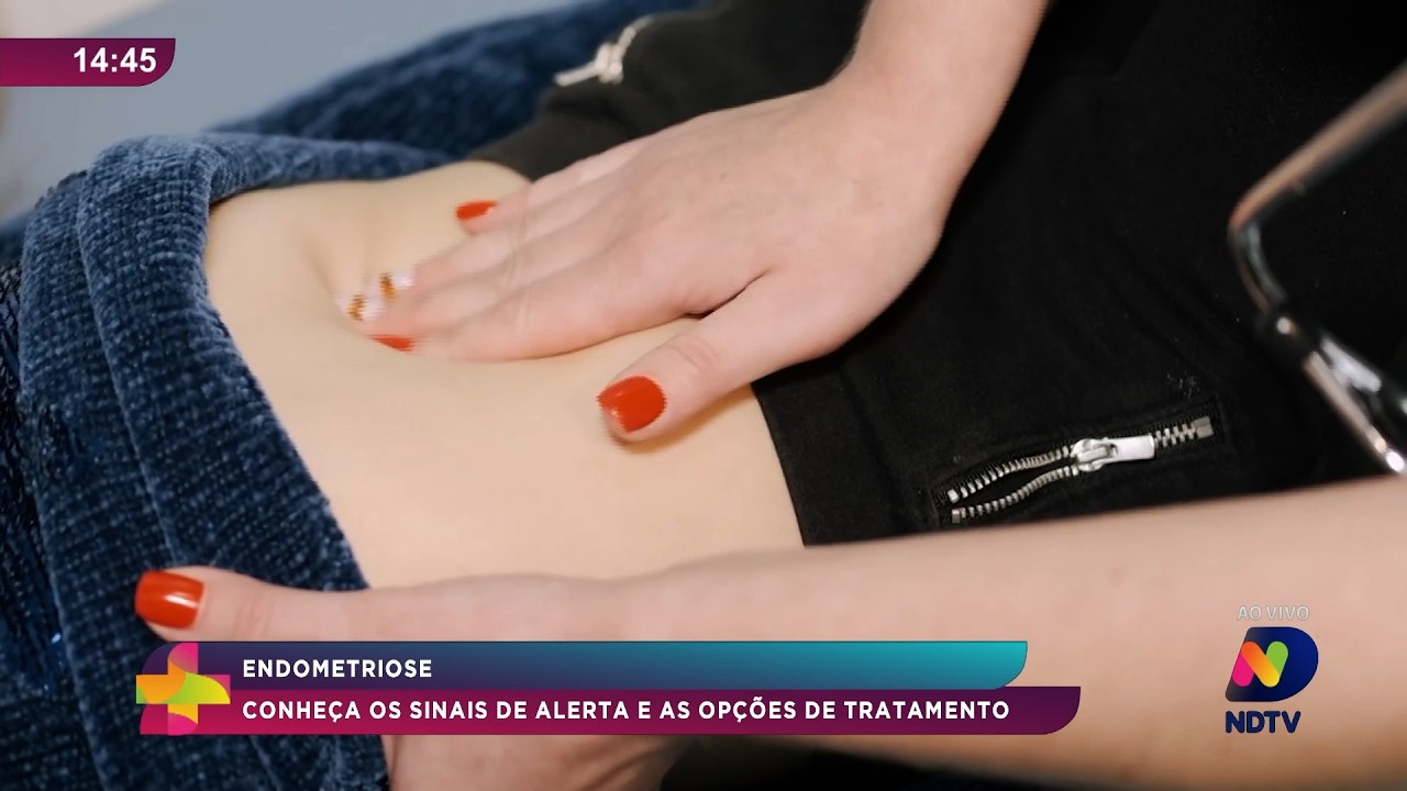 Endometriose: conheça os sinais de alerta e opções de tratamento