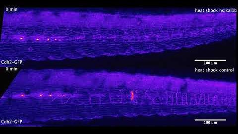 Collective cell migration in the Zebrafish lateral line