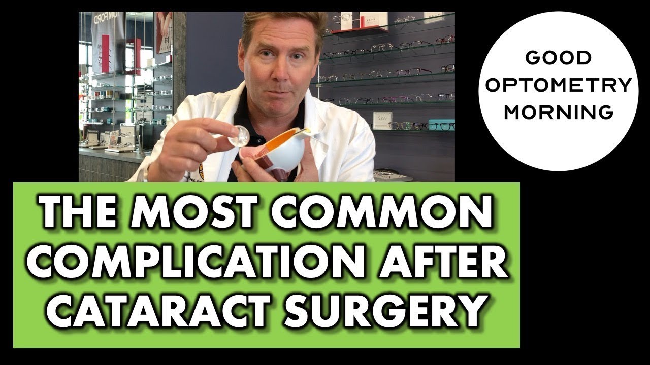 The Most Common Complication After Cataract Surgery: What Is Posterior Capsular Opacification.