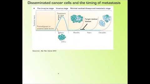Mount Sinai Dept. of Otolaryngology Modeling Dormancy and Metastasis in HNSCC 8-16