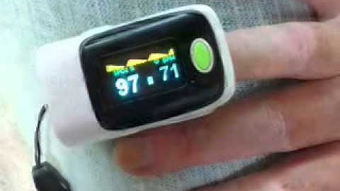 パルスオキシメーター(pulse oximeter)