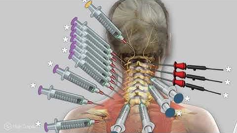 Enhance Your Legal Presentation With Visuals