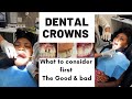 WATCH BEFORE YOU GET DENTAL CROWNS | GOOD &amp; BAD |PROCEDURE EXPLAINED
