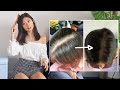 MY HAIR LOSS STORY - HOW I GREW IT BACK 我怎樣成功拯救多年的脫髮問題 ~ Emi