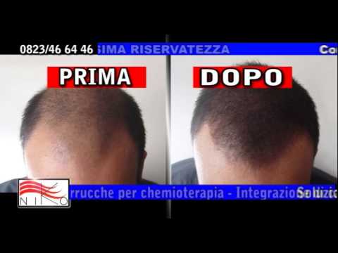 0823 466446 protesi capelli traspiranti con effetto micropelle - YouTube