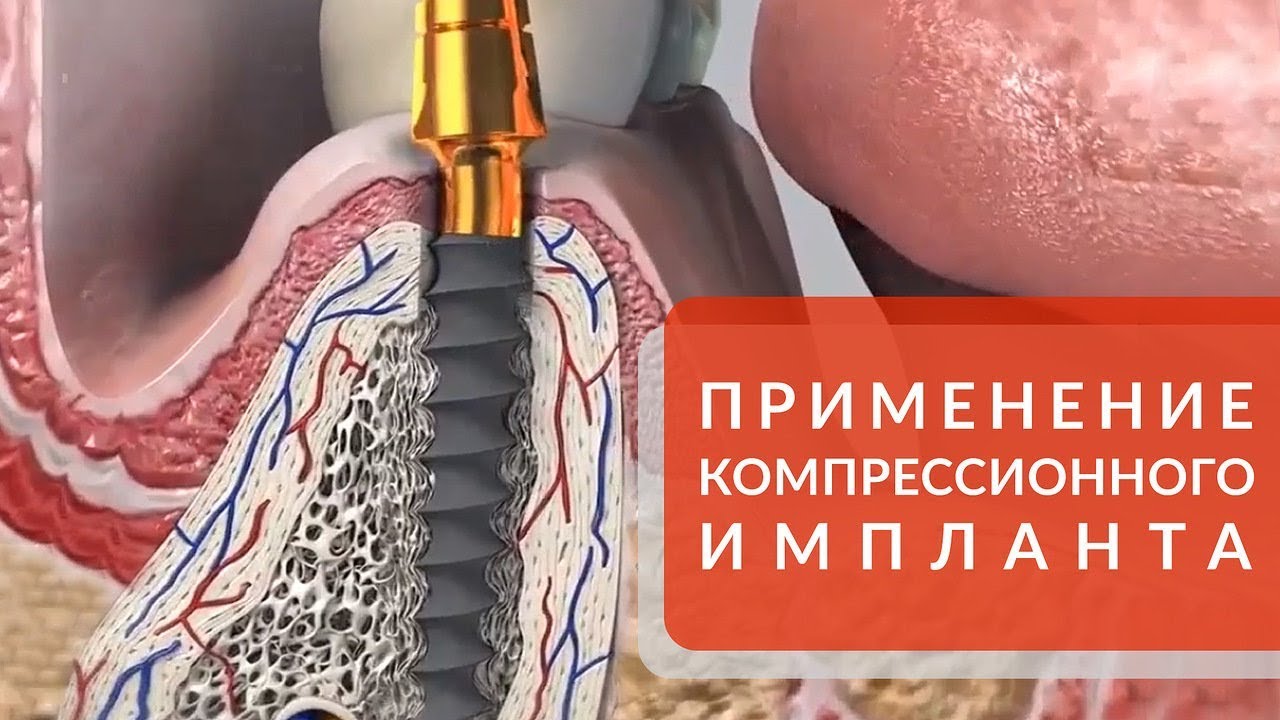 Опытные имплантологи с многолетней практикой