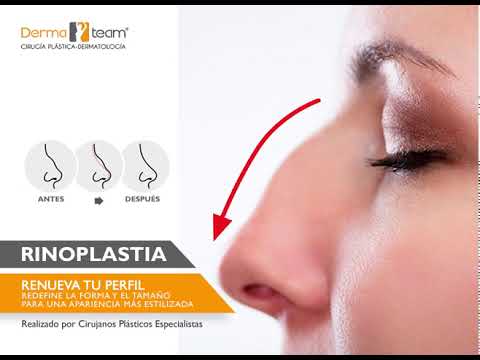 DermaTeam - Rinoplastia (animación) camera iphone 8 plus apk