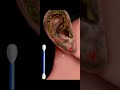 ear cleaning asmr video #music #animation #ihavethisthingwithplants