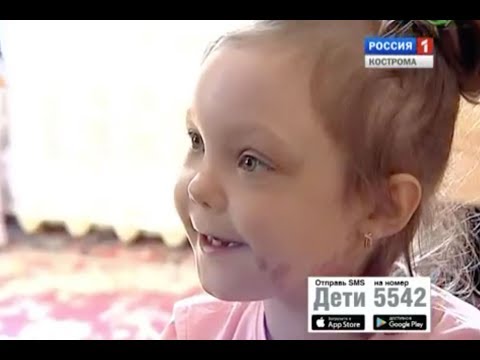 Софа Комарова, 6 лет, синдром МакКьюна – Олбрайта – Брайцева – остеопороз (хрупкость костей)