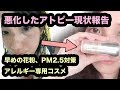 ヒルドイド保険適用外結果！アレルバリア エッセンスBBで花粉対策！