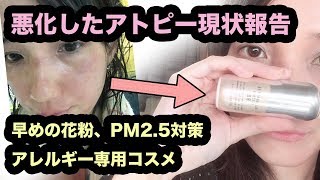 ヒルドイド保険適用外結果！アレルバリア エッセンスBBで花粉対策！