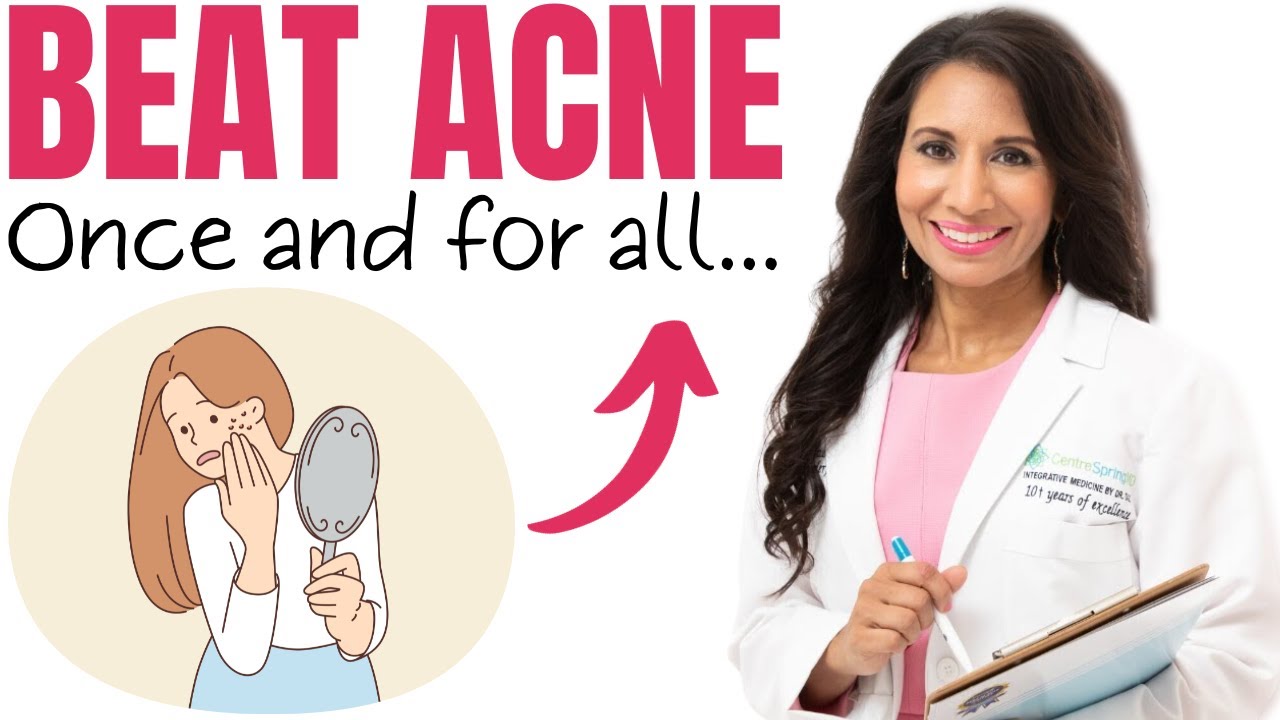 Adult Acne Epidemic: What You Need to Know to Get Rid of HORMONAL Acne - Once and for all! | Dr. Taz