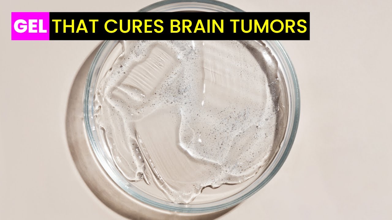 New Gel Offers Hope for Glioblastoma Treatment | Future Technology ...