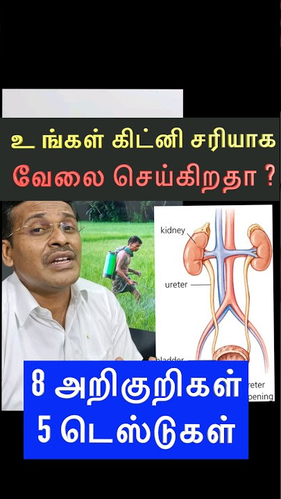 8 Kidney Failure Symptoms ! |  #drkarthikeyantamil #tips #cure