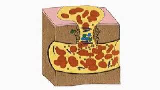 The Blood Clotting Process