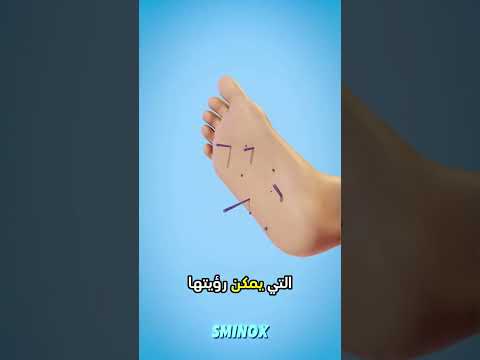 ماذا تفعل إذا خطوت على قنفذ البحر قنفذ البحر إسعافات أولية حقائق