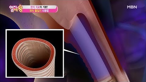 천식 치료의 기본! ＜천식 흡입기 사용법!＞